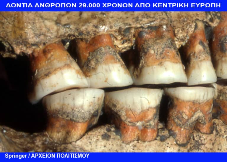 Άνθρωποι πριν 29.000 χρόνια τρυπούσαν τα μάγουλα και τα χείλη τους – του Γ. Λεκάκη
