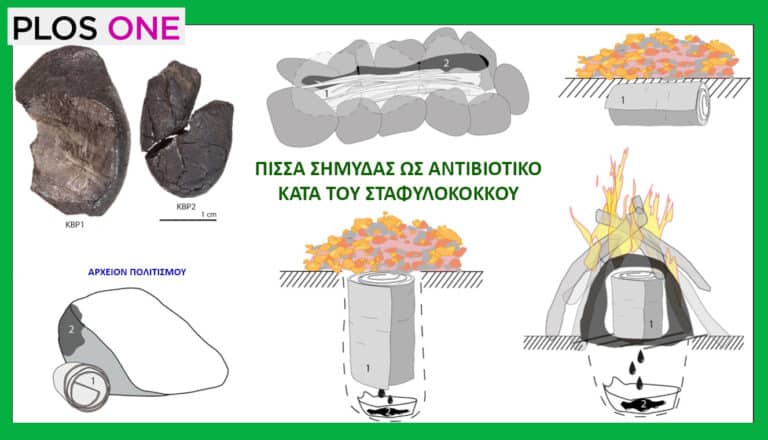 Οι Νεάντερταλ χρησιμοποιούσαν πίσσα σημύδας, ως αντιβιοτικό κατά του σταφυλόκοκκου – του Γ. Λεκάκη