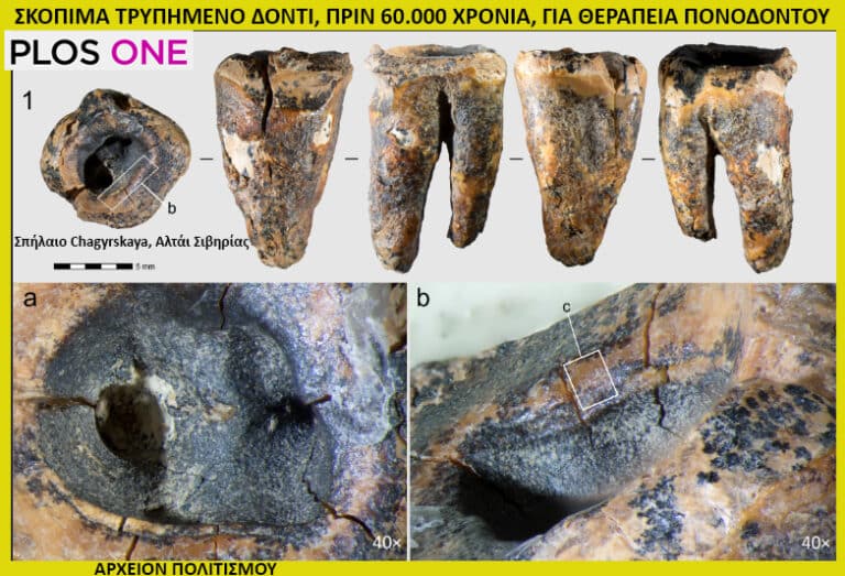 Οι άνθρωποι είχαν εξελιγμένη οδοντιατρική, πριν 60.000 χρόνια! – του Γ. Λεκάκη