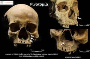 Composite image of a fossil skull shown from front, side, and lower view; white arrows highlight dental/jaw features; scale bars indicate about 4 cm; ScienceDirect credit text visible.